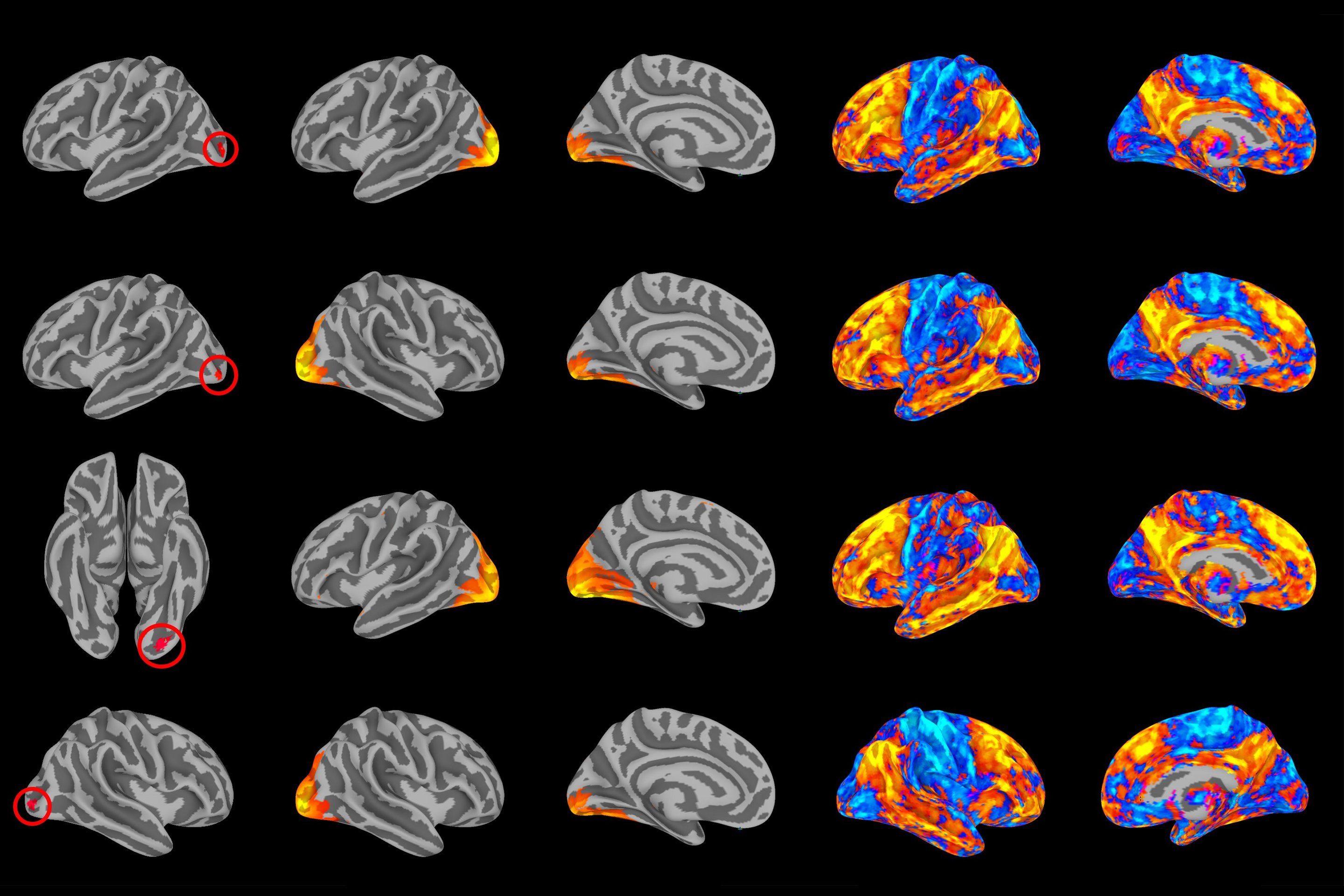 Breakdown of brain’s visual networks linked to mental illness